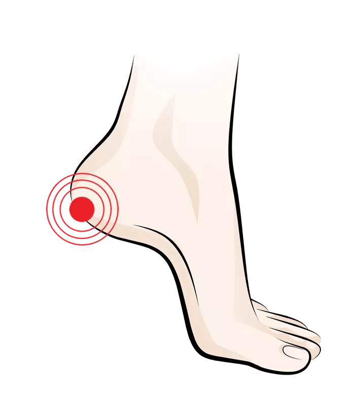 Heel Pain Footlogics Canada
