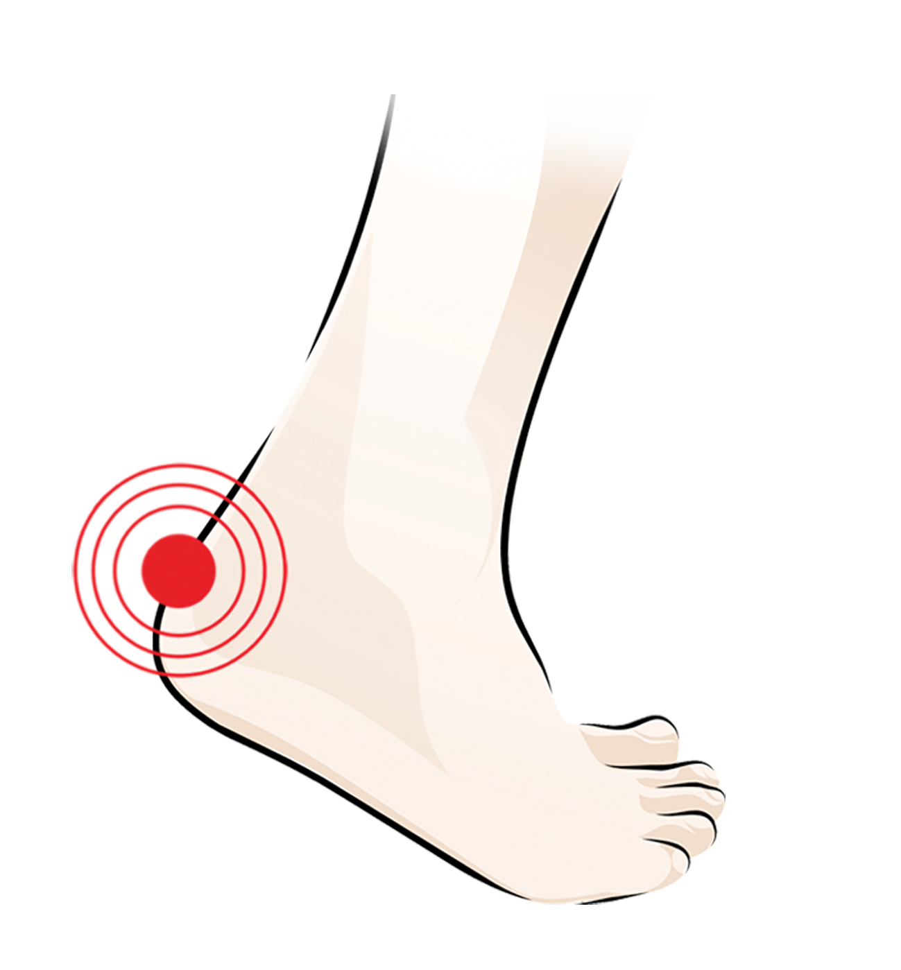 Illustration of a human foot with a red target symbol highlighting pain or discomfort at the heel area.