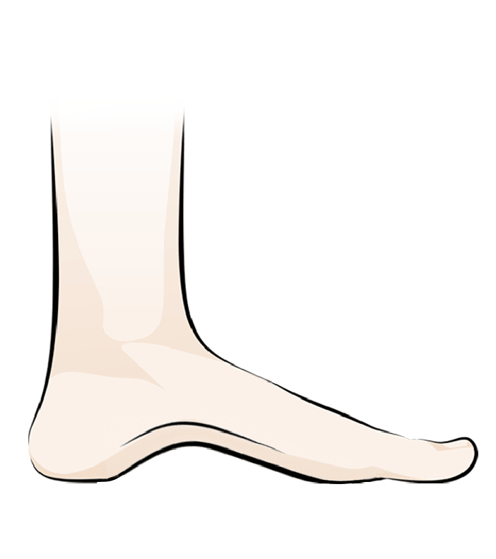 insoles for high arches